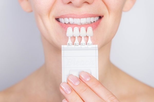 tooth whitening