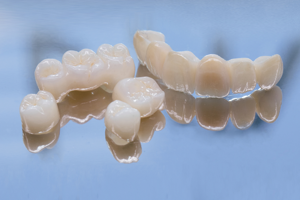 dental prosthetics