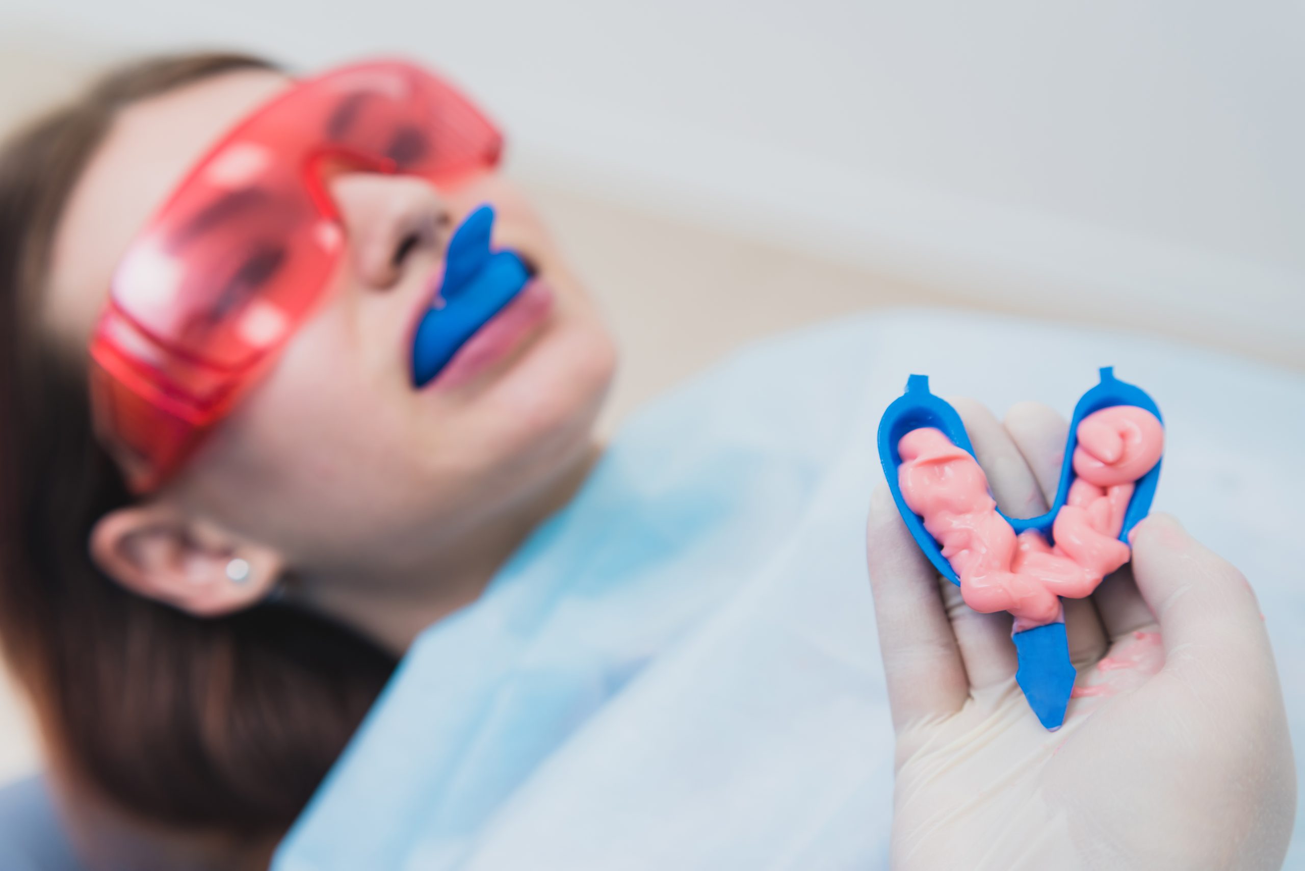 fluoride treatment in tray