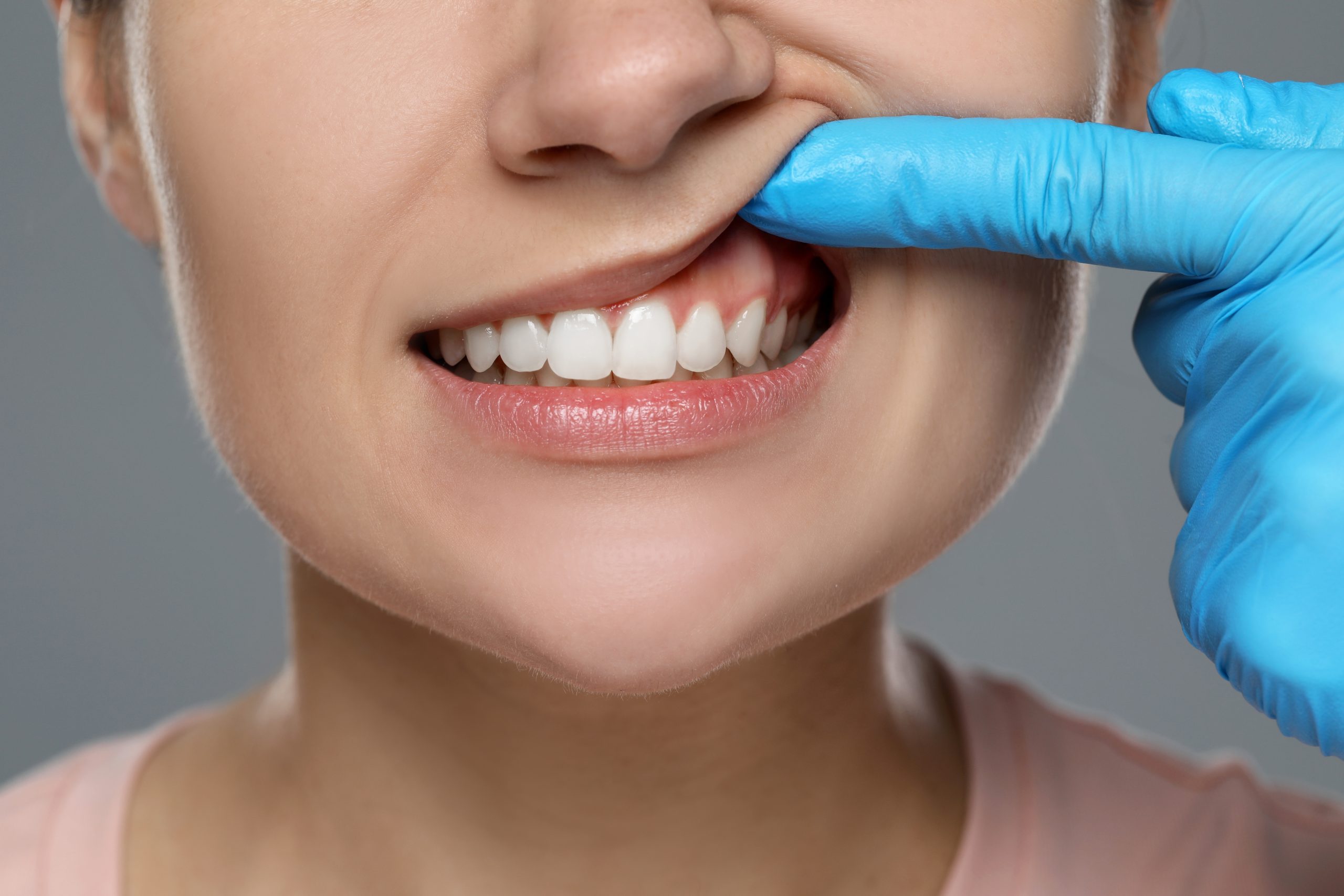 dentist examining patient's gums